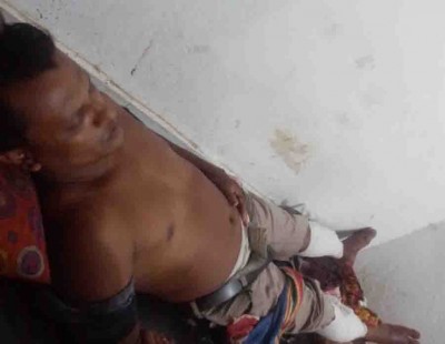 বাগেরহাটে চাচাতো ভাইয়ের দুই পা ভেঙ্গে দিলেন সাবেক ইউপি সদস্য